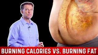 Burning Calories vs. Burning FAT Calories? – Dr. Berg