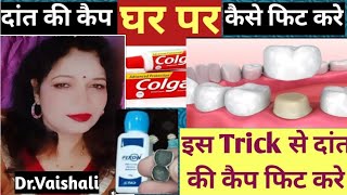 दांत की कैप घरमे कैसे लगाएं ?How to fix teeth cap at home?