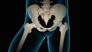 Minimally Invasive Total Hip Replacement | THR | Nucleus Health