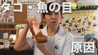 足裏のタコ魚の目ができる原因とは？