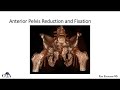 definitive treatment of pelvic ring injuries 2 of 3