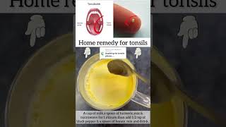 Best Remedy to Cure of Tonsilis.. #tonsilstones  #tonsils  #shorts