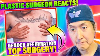 Plastic Surgeon Reacts to What Happens During TOP Surgery!