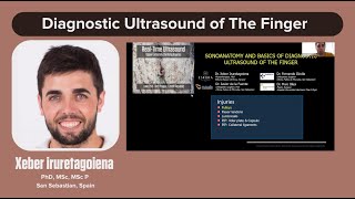 Sonoanatomy and Basics of Diagnostic Ultrasound of the Finger