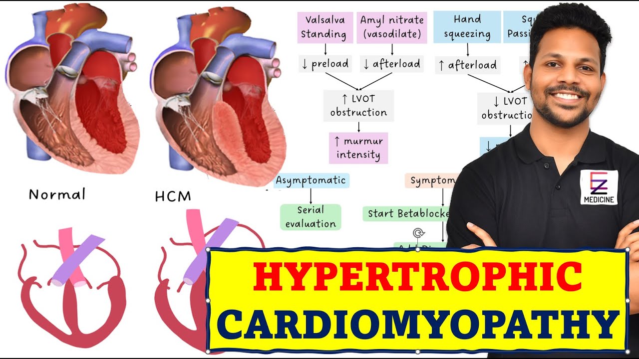 Hypertrophic Cardiomyopathy Explained Youtube