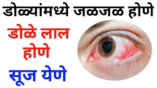 डोळे लाल होणे, सूज येणे, डोळ्यांमध्ये जळजळ होणे यावर घरगुती उपाय - Dole lal hone, Dole sujane upay