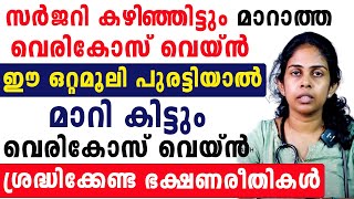 സർജറി കഴിഞ്ഞിട്ടും മാറാത്ത വെരികോസ് വെയ്‌ൻ ഈ ഒറ്റമൂലി പുരട്ടിയാൽ മാറി കിട്ടും