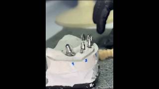 Customized abutments on cemented zirconia framework. Designed on exocad. #dentistry #exocad #cam