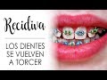 ¿SE VUELVEN A TORCER LOS DIENTES? | RECIDIVA EN ORTODONCIA