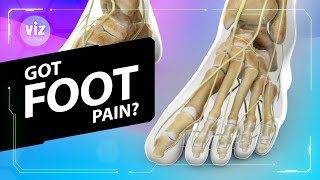 The cause of your foot pain (3D Animation)