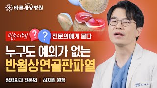 반월상연골판파열, 누구도 예외는 없습니다⚠