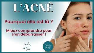 Pourquoi j'ai de l'acné ? Les Véritables Causes et les Solutions Naturelles Qui Fonctionnent