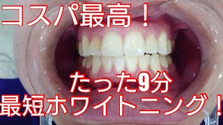 【最短・最安】クイックホワイトニング／歯医者×ＡＳＭＲ／しみない、痛くない、そして、歯が白くなる、たった9分の簡単ホワイトニング！／代々木 歯医者