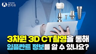 3차원 3D CT촬영을 통해 임플란트 정보를 알 수 있나요? (Can I know the implant information through 3D CT scan?)