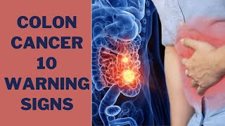 Early Warning Signs Of Colon Cancer You Should NOT IGNORE