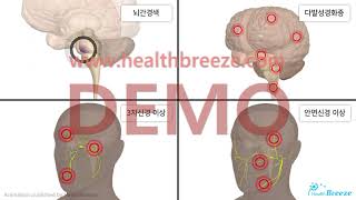 [시연용] b0295aako_순목반사검사 안내