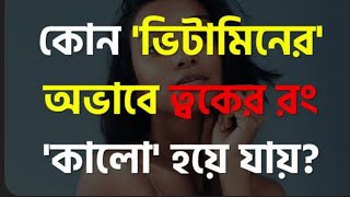 কোন ভিটামিনের অভাবে ত্বকের রং কালো হয়ে যায় ? ত্বকে মেচেদা পড়ে যায়?এটা জানলে ত্বক হবে ফর্সা চকচকে