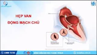 Điều trị nội khoa bệnh lý hẹp, hở van động mạch chủ