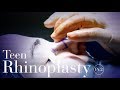 Teen Rhinoplasty (Nose Job) - Pt.2