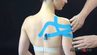 Acti-Tape - Frozen Shoulder