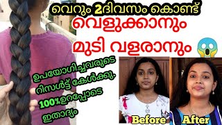 വെറും 2ദിവസം മതി ശരീരത്തിലെ കറുത്ത പാടുകൾ മാറ്റി വെളുക്കാനും മുടിയിലെ പ്രശ്നങ്ങൾ മാറ്റി മുടി വളരാനും