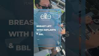 BBL & Breast Lift with Implants