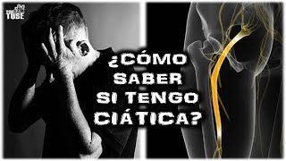 Ciatica la verdadera cura sin mentiras