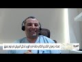 صباح العربية ما هي ابرز أنواع التخدير الطبي؟