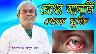 চোখের অ্যালার্জি থেকে মুক্তি | Prof.Dr.Md Abdul Mannan Eye Specialist, Phaco Surgeon \u0026 Retina Expert