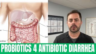 🌿 Best Probiotics for Antibiotic Diarrhea | Lactobacillus rhamnosus GG | Saccharomyces Boulardii