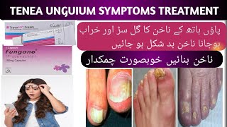 TINEA UNGUIUM || NAIL INFECT || NAIL FUNGUS || NAIL FUNGUS TREATMENT || NAIL FUNGUS TREATMENT