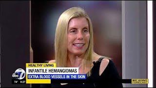 Dr. Robin Gehris Explains Infantile Hemangiomas, What They Are and How to Treat Them