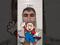 #Hair #Transplant #Mario #Challenge