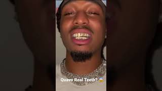 Quavo Real Teeth? 😱