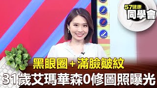 黑眼圈+滿臉皺紋 31歲艾瑪華森零修圖照曝光【57健康同學會】2022.07.30｜張予馨 謝牧翰 詹東峻 斯棋  Angela 亞梅