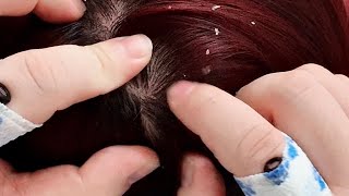 Silent ASMR Scalp Care: Gentle Exfoliation \u0026 Dandruff Removal (No Talking)