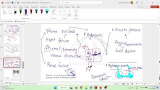 Lec 4 Consolidation   Causes of Diffuse Consolidation mkv