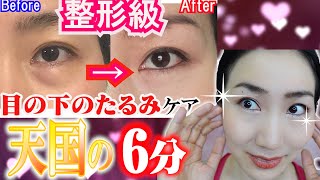 目の下のたるみを取る方法 目の下のたるみを取る方法