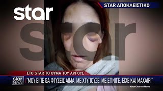 Αποκλειστικά στο Star το θύμα τους Άργους: «Μου έλεγε θα φτύσεις αίμα»