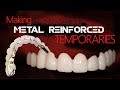 Making Metal Reinforced Temporaries | Dental Lab Techniques