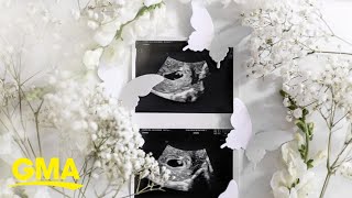 5 women share what it's like to have a miscarriage l GMA Digital