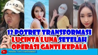 12 potret transformasi LUCINTA LUNA setelah operasi ganti kepala