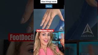 Doctor explains the science of warts