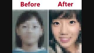 (REUPLOADED) SNSD Plastic Surgery 韓国 少女時代　整形