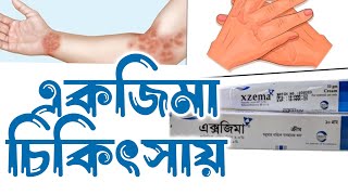 Xzema Cream uses | এক্সজিমা ক্রিম এর ব্যবহার