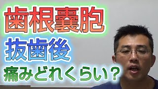 歯根嚢胞による抜歯後の痛みはどれくらいか？【根管治療】