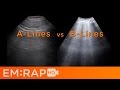 Ultrasound of Pulmonary Edema