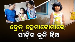 Apana Eka Nuhanty | Little girl suffering from 'brain hematoma' seeks help for treatment