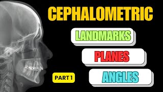 Cephalometric Analysis for Beginners | Landmarks, Planes & Angles (Part 1)