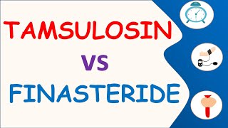 Tamsulosin vs Finasteride | Which is better?